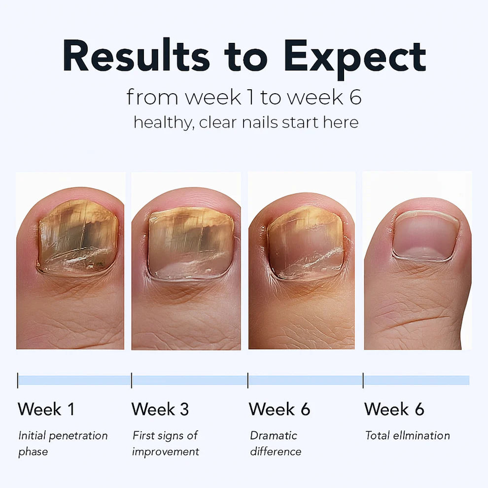 FungalFix™ - Fungal Nail Renewal Patches